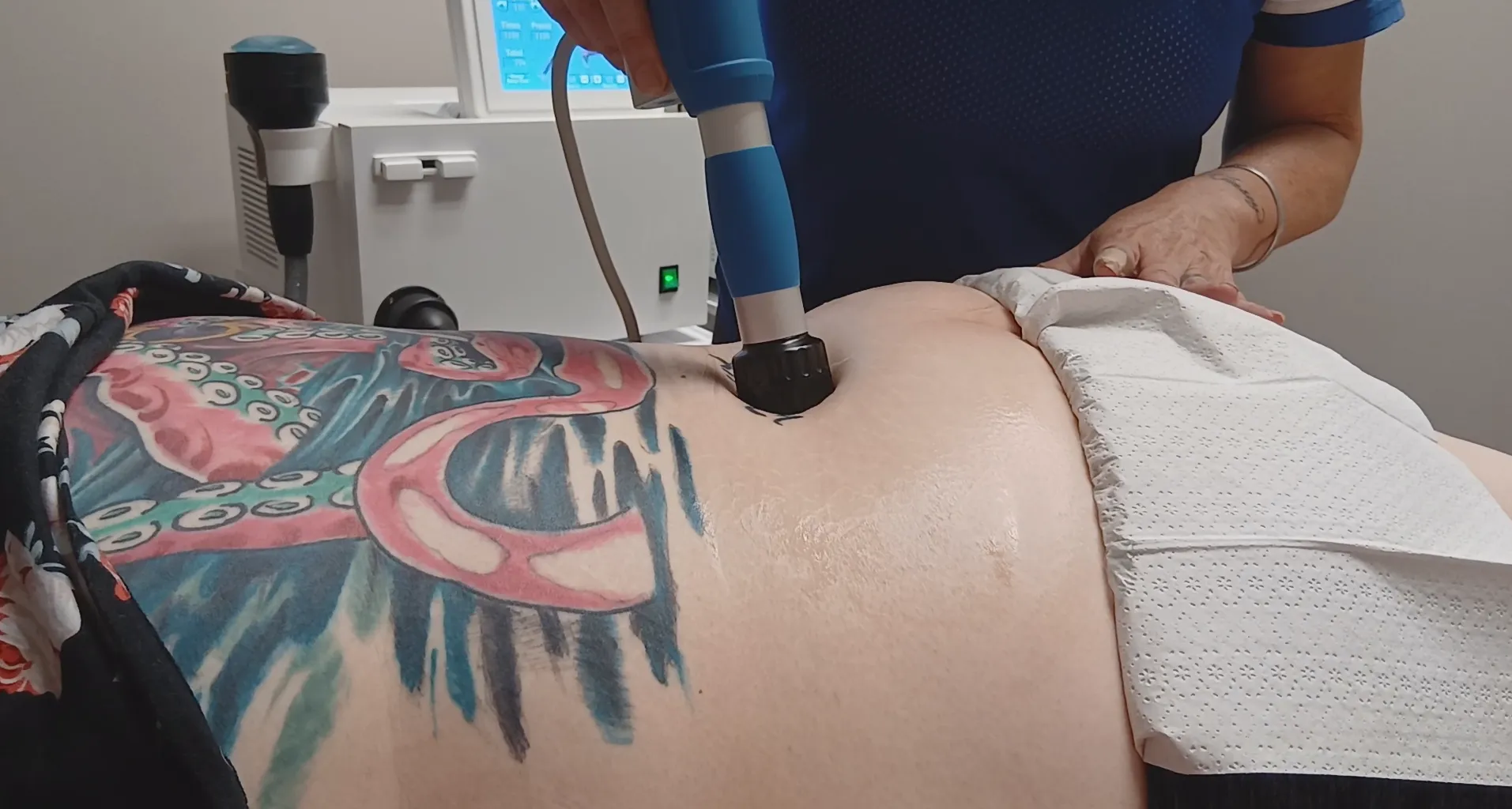 Shockwave Therapy